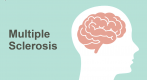 What Is Multiple Sclerosis (MS)?