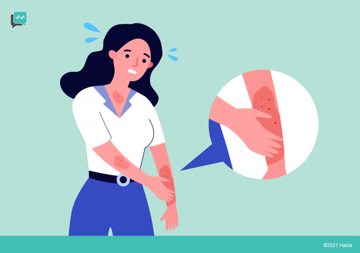 The Itch That Never Goes Away